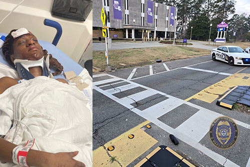 NSU student hospitalized after being struck in crosswalk on University ...